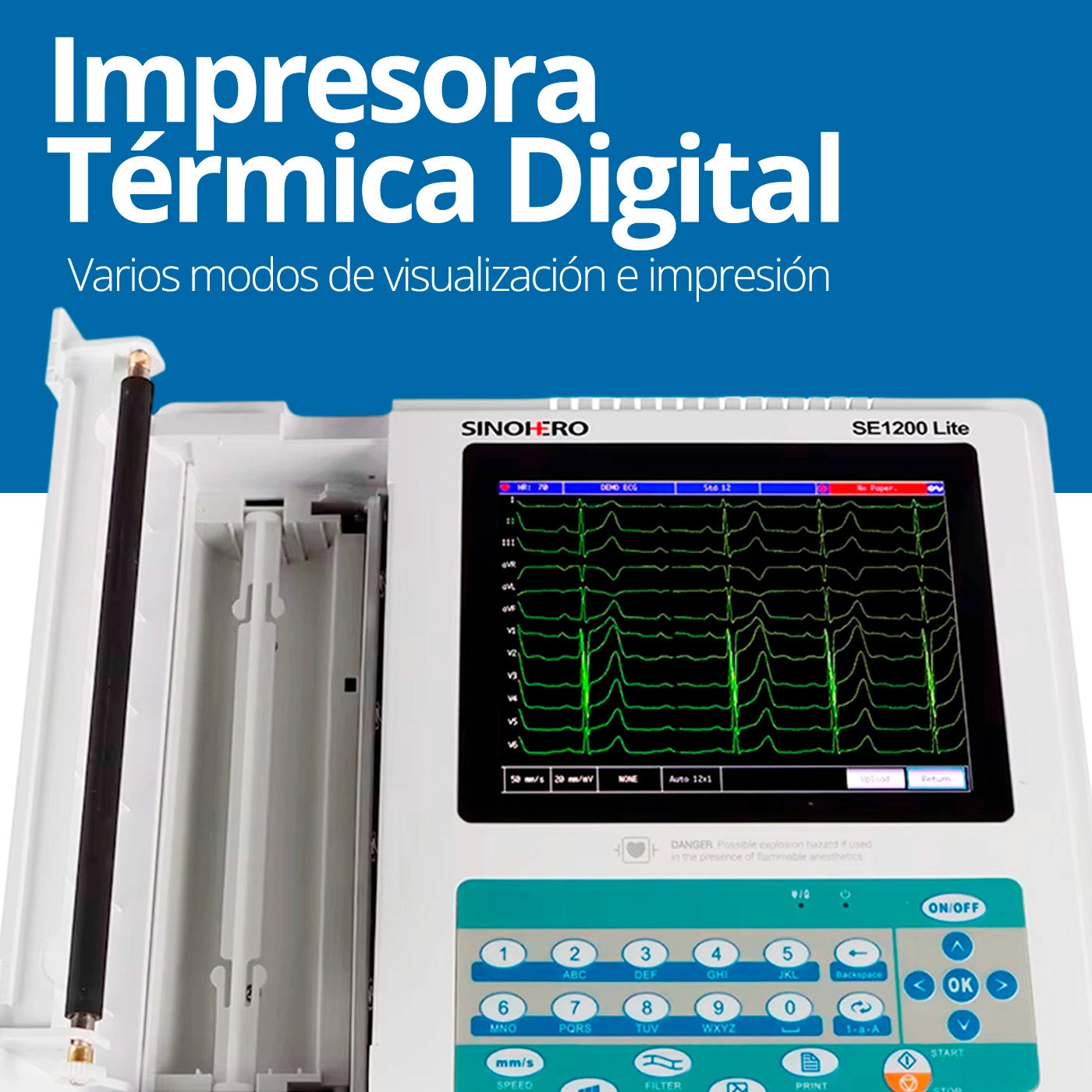Impresora térmica digital del SE1200lite para registros de ECG precisos