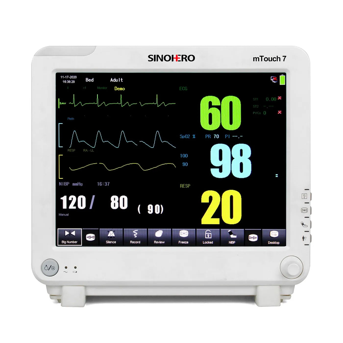 Monitor Multiparámetros Sinohero mTouch 7 - 2IBP, ETCO2, ECG, SPO2, FC, NIBP, TEMP, FR y Batería Recargable