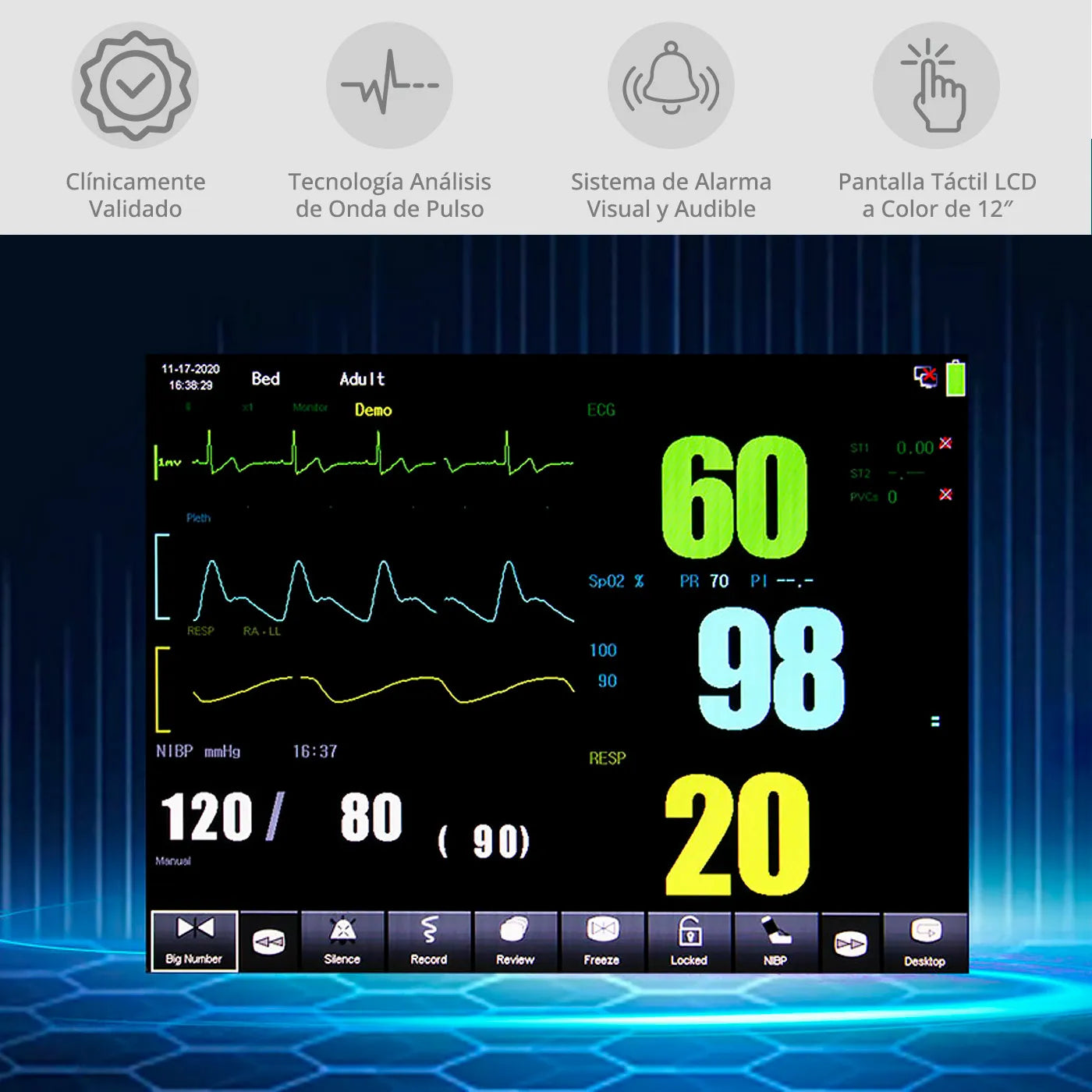 Monitor Multiparámetros Sinohero mTouch 7 - 2IBP, ETCO2, ECG, SPO2, FC, NIBP, TEMP, FR y Batería Recargable