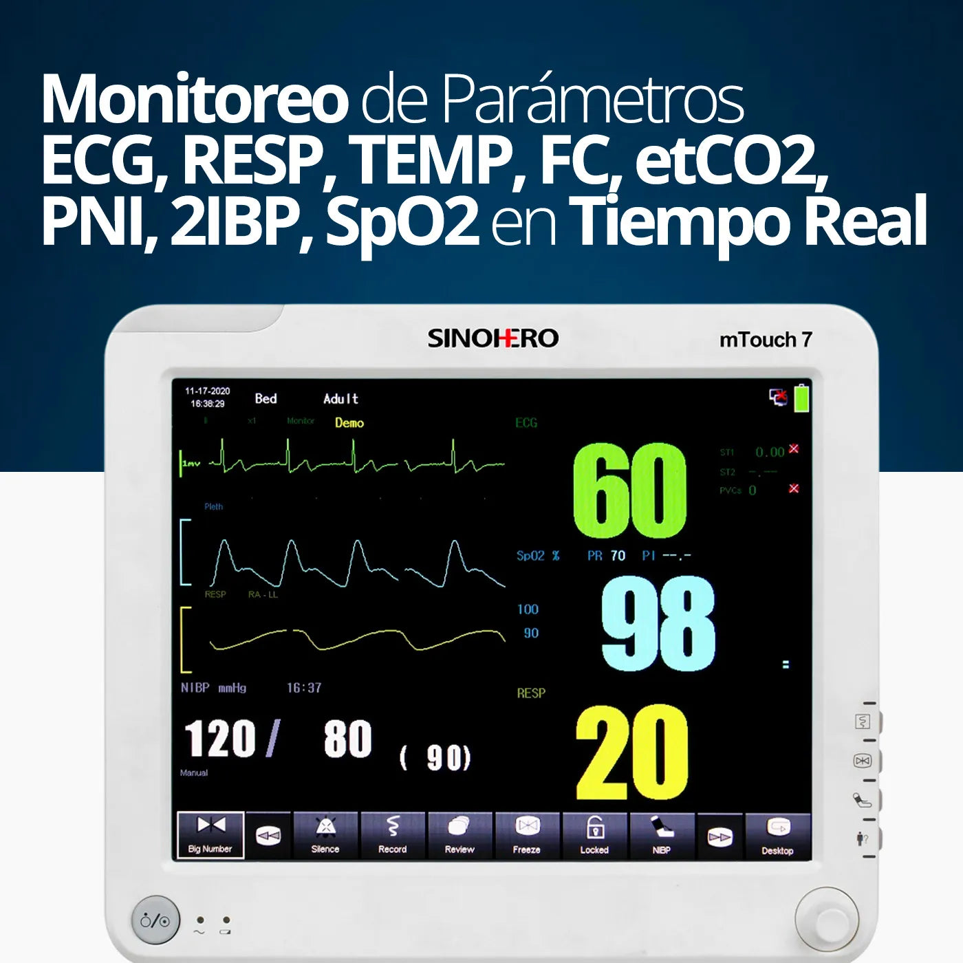 Monitor Multiparámetros Sinohero mTouch 7 - 2IBP, ETCO2, ECG, SPO2, FC, NIBP, TEMP, FR y Batería Recargable