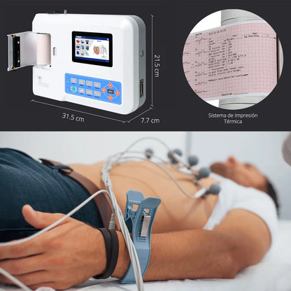 Electrocardiógrafo ECG 300G 3 Canales Contec con Carro Z - TOPMEDIC