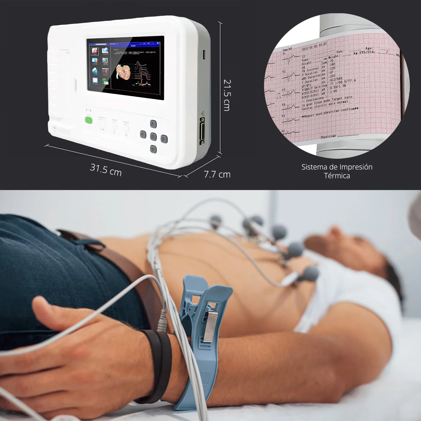 Electrocardiógrafo ECG 600G 6 Canales Contec con Carro Z - TOPMEDIC