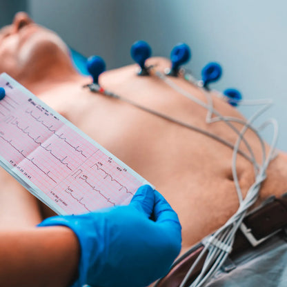 Electrodos ECG para Electrocardiógrafo Pediátrico - TOPMEDIC